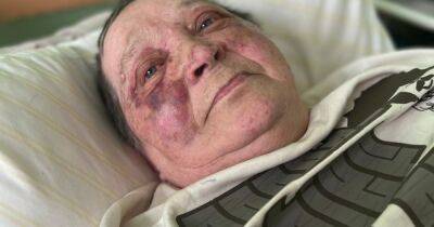 В Херсоне рашисты сломали позвоночник 75-летней женщине-волонтеру, которая не хотела отдавать украинский паспорт - dsnews.ua - Россия - Украина - Херсон - Херсон